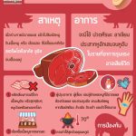เนื้อดิบทุกชนิด เน้นปรุงสุกสดใหม่ ไม่เน้นกินดิบเสี่ยงโรคภัยใกล้ตัว